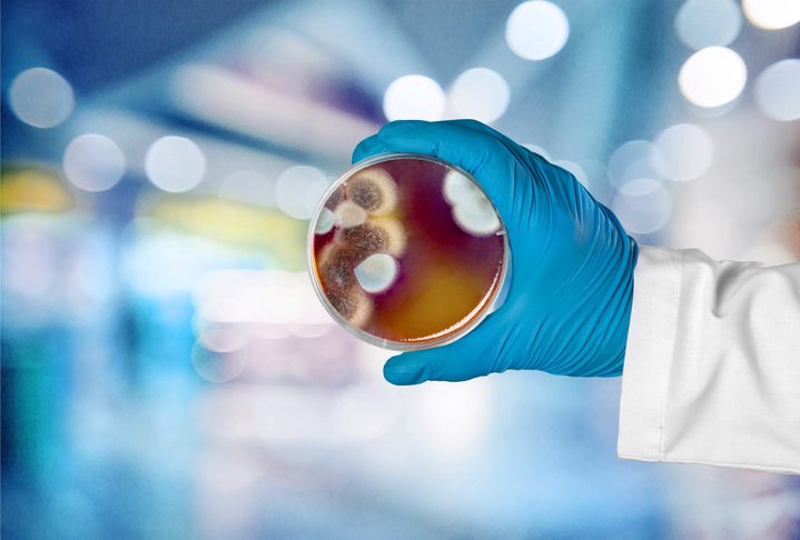 Microbiology laboratory test in scientist hand on background